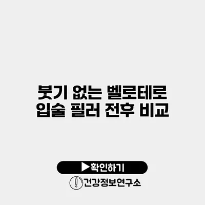붓기 없는 벨로테로 입술 필러 전후 비교